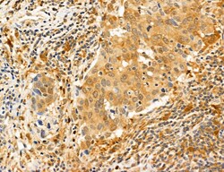 Invitrogen PYGL Polyclonal Antibody 100 &mu;L; Unconjugated:Antibodies,