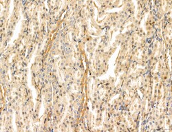 Invitrogen PYGL Polyclonal Antibody 100 &mu;L; Unconjugated:Antibodies,