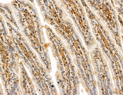 Invitrogen PYGL Polyclonal Antibody 100 &mu;L; Unconjugated:Antibodies,