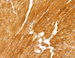 Invitrogen PYGL Polyclonal Antibody 100 &mu;L; Unconjugated:Antibodies,