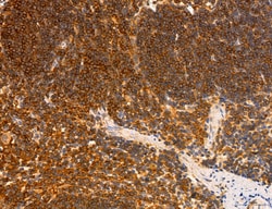 Invitrogen PYGL Polyclonal Antibody 100 &mu;L; Unconjugated:Antibodies,