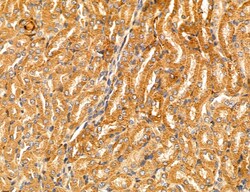 Invitrogen PYGL Polyclonal Antibody 100 &mu;L; Unconjugated:Antibodies,