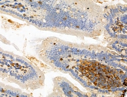 Invitrogen PYGL Polyclonal Antibody 100 &mu;L; Unconjugated:Antibodies,