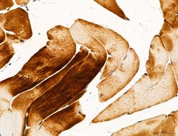 Invitrogen PYGL Polyclonal Antibody 100 &mu;L; Unconjugated:Antibodies,