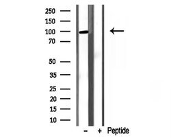 Invitrogen PYGL Polyclonal Antibody 100 &mu;L; Unconjugated:Antibodies,
