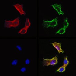SULT1E1 Polyclonal Antibody:Antibodies, Polyclonal