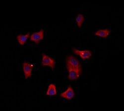 SULT1E1 Polyclonal Antibody:Antibodies, Polyclonal