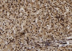 SULT1E1 Polyclonal Antibody:Antibodies, Polyclonal