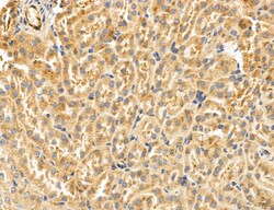 SULT1E1 Polyclonal Antibody:Antibodies, Polyclonal
