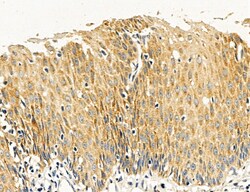 SULT1E1 Polyclonal Antibody:Antibodies, Polyclonal