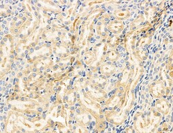 SULT1E1 Polyclonal Antibody:Antibodies, Polyclonal