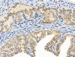 SULT1E1 Polyclonal Antibody:Antibodies, Polyclonal