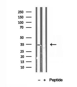 SULT1E1 Polyclonal Antibody:Antibodies, Polyclonal