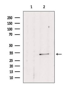 SULT1E1 Polyclonal Antibody:Antibodies, Polyclonal