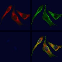 Invitrogen UGT2B7 Polyclonal Antibody 100 &mu;L; Unconjugated:Antibodies,