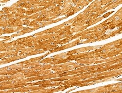 Invitrogen UGT2B7 Polyclonal Antibody 100 &mu;L; Unconjugated:Antibodies,