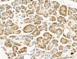 Invitrogen UGT2B7 Polyclonal Antibody 100 &mu;L; Unconjugated:Antibodies,
