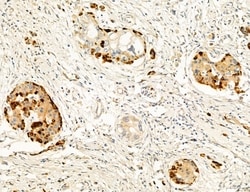 Invitrogen UGT2B7 Polyclonal Antibody 100 &mu;L; Unconjugated:Antibodies,