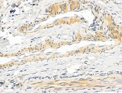 Invitrogen UGT2B7 Polyclonal Antibody 100 &mu;L; Unconjugated:Antibodies,