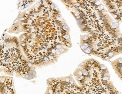 Invitrogen UGT2B7 Polyclonal Antibody 100 &mu;L; Unconjugated:Antibodies,