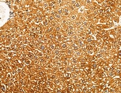 Invitrogen UGT2B7 Polyclonal Antibody 100 &mu;L; Unconjugated:Antibodies,
