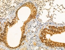 Invitrogen UGT2B7 Polyclonal Antibody 100 &mu;L; Unconjugated:Antibodies,