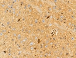 Invitrogen UGT2B7 Polyclonal Antibody 100 &mu;L; Unconjugated:Antibodies,