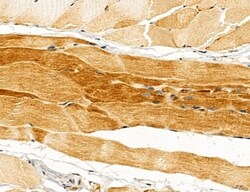 Invitrogen UGT2B7 Polyclonal Antibody 100 &mu;L; Unconjugated:Antibodies,