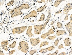 Invitrogen UGT2B7 Polyclonal Antibody 100 &mu;L; Unconjugated:Antibodies,