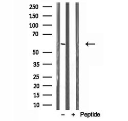 Invitrogen UGT2B7 Polyclonal Antibody 100 &mu;L; Unconjugated:Antibodies,