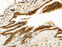 Invitrogen ACSL4 Polyclonal Antibody 100 &mu;L; Unconjugated:Antibodies,