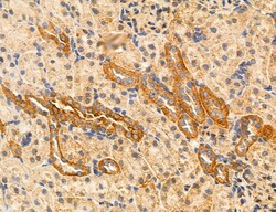 Invitrogen ACSL4 Polyclonal Antibody 100 &mu;L; Unconjugated:Antibodies,