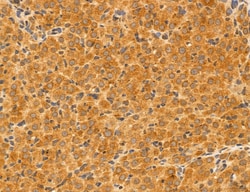 Invitrogen ACSL4 Polyclonal Antibody 100 &mu;L; Unconjugated:Antibodies,