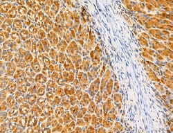 Invitrogen ACSL4 Polyclonal Antibody 100 &mu;L; Unconjugated:Antibodies,