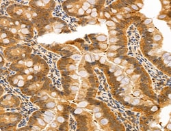 Invitrogen ACSL4 Polyclonal Antibody 100 &mu;L; Unconjugated:Antibodies,