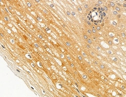 Invitrogen ACSL4 Polyclonal Antibody 100 &mu;L; Unconjugated:Antibodies,