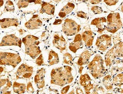 Invitrogen ACSL4 Polyclonal Antibody 100 &mu;L; Unconjugated:Antibodies,