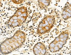 Invitrogen ACSL4 Polyclonal Antibody 100 &mu;L; Unconjugated:Antibodies,