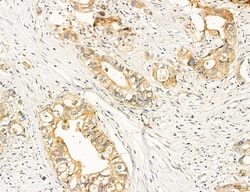 Invitrogen ACSL4 Polyclonal Antibody 100 &mu;L; Unconjugated:Antibodies,