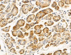 Invitrogen ACSL4 Polyclonal Antibody 100 &mu;L; Unconjugated:Antibodies,
