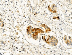 Invitrogen ACSL4 Polyclonal Antibody 100 &mu;L; Unconjugated:Antibodies,