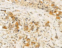 Invitrogen ACSL4 Polyclonal Antibody 100 &mu;L; Unconjugated:Antibodies,