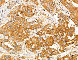 Invitrogen ACSL4 Polyclonal Antibody 100 &mu;L; Unconjugated:Antibodies,