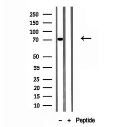 Invitrogen ACSL4 Polyclonal Antibody 100 &mu;L; Unconjugated:Antibodies,