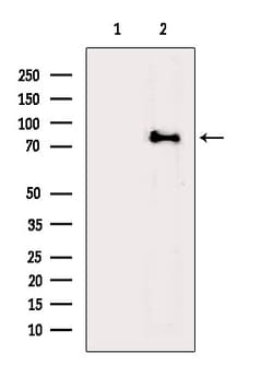 Invitrogen ACSL4 Polyclonal Antibody 100 &mu;L; Unconjugated:Antibodies,