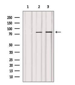 Invitrogen ACSL4 Polyclonal Antibody 100 &mu;L; Unconjugated:Antibodies,