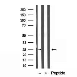 ATP Synthase B1 Polyclonal Antibody:Antibodies, Polyclonal