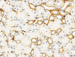 ATP Synthase B1 Polyclonal Antibody:Antibodies, Polyclonal