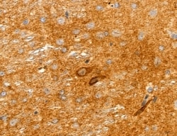 Invitrogen Clathrin Light Chain Polyclonal Antibody 100 &mu;L; Unconjugated:Antibodies,