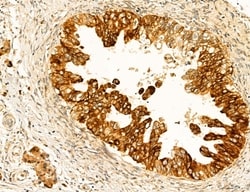 Invitrogen Clathrin Light Chain Polyclonal Antibody 100 &mu;L; Unconjugated:Antibodies,